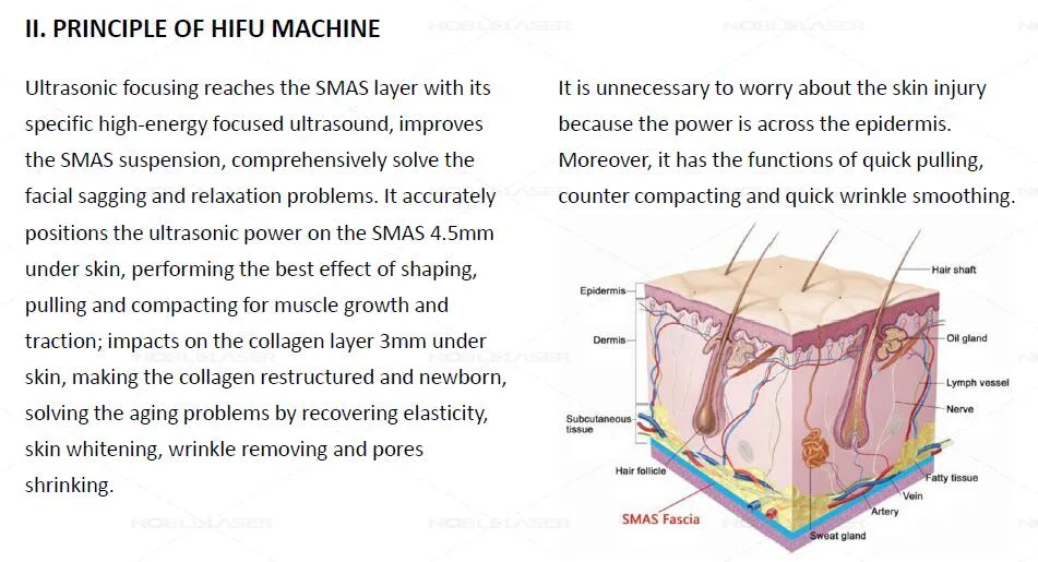 Portable 15000 Shots 3D Hifu for Face Lift and Body Slimming Beijing Noble Laser Hf-C