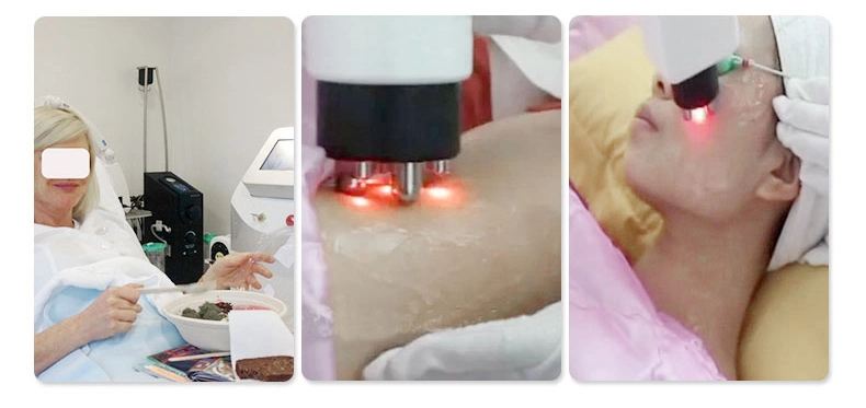 4 in 1 Multifunctional Beauty Machine Cryolipolysis +Cavitation+RF+Lipolaser for Weight Loss Wrinkle Removal