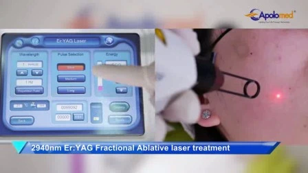 Macchina laser per la rimozione dei tatuaggi E-Light IPL RF ND YAG Laser multifunzione per il ringiovanimento della pelle Macchina per la depilazione per uso domestico nel centro salone di bellezza SPA Ospedale